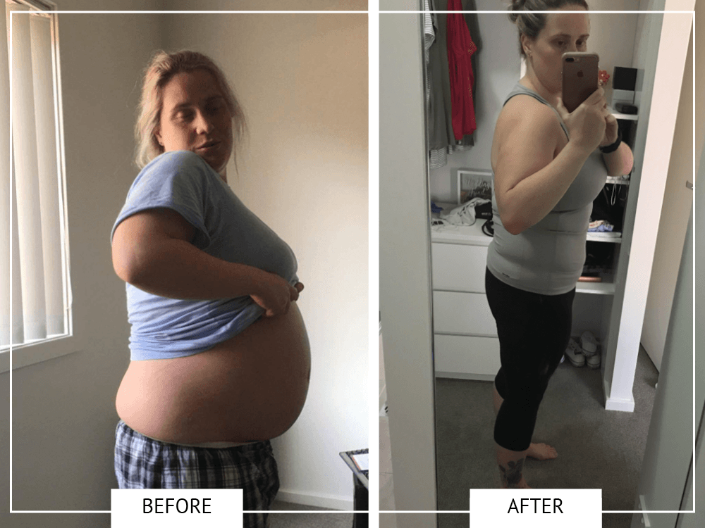New Mum Emma Loses 19kgs